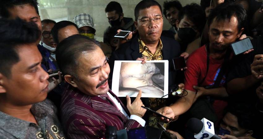 Kasus Tewasnya Brigadir J, Sudah Tidak Misteri, Tinggal Tetapkan Tersangka