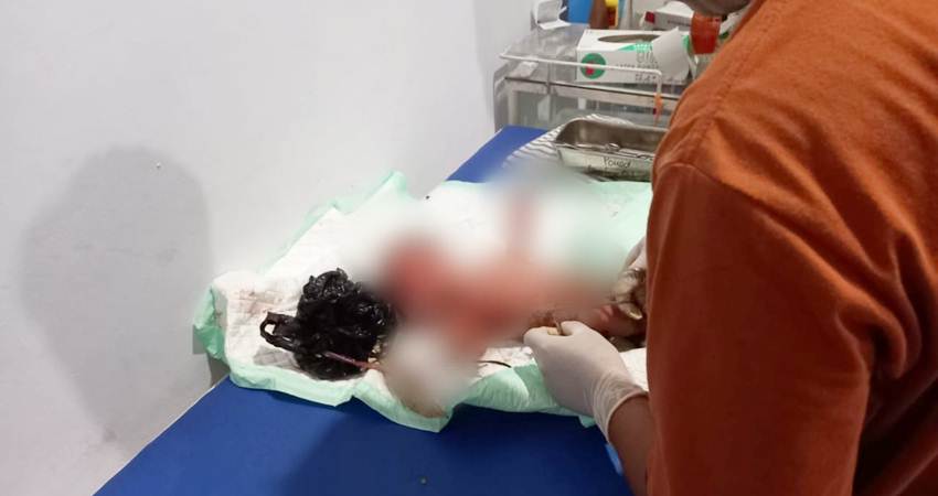 Seorang bayi berjenis kelamin laki-laki yang ditemukan di tepi jalan saat dibersihkan badannya dan serta dirawat secara medis di Puskemas Suwawa, Senin (1/1/2024).. (Foto : Istimwa).
