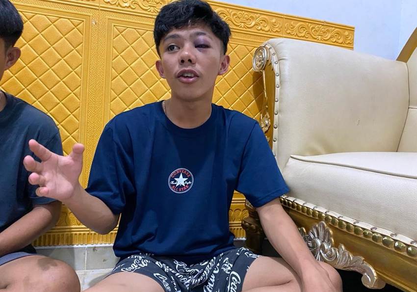 Kondisi korban, Abdul Ajiz Potabuga (17) warga Kecamatan Kotamobagu Utara, Kota Kotamobagu, Provinsi Sulut saat diwawancarai awak media,(foto Istimewa).