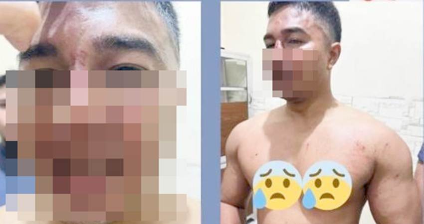 Kondisi Korban dugaan penganiayaan oknum polisi berlumuran darah di bagian wajah.