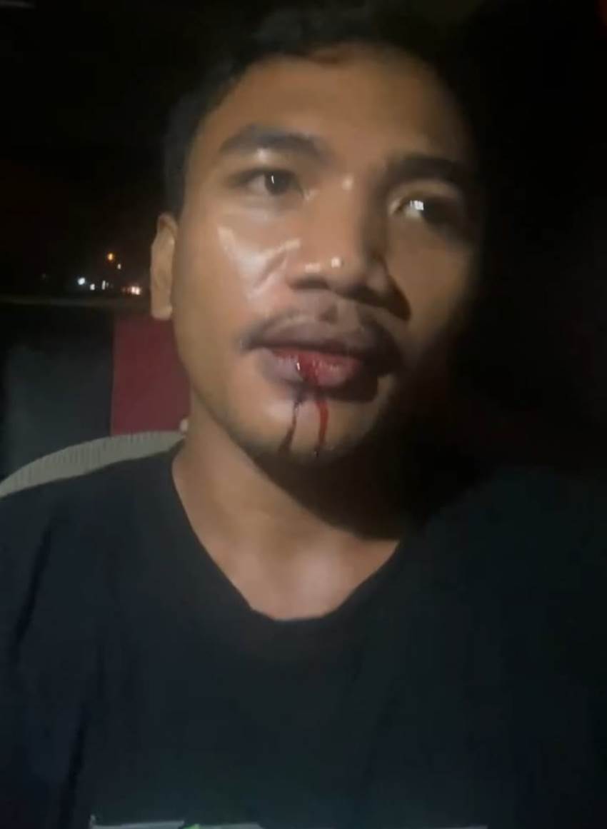 Potongan vidio Aldy Hasan saat curhat mengaku dianiaya oknum polisi di wilayah Kecamatan Atinggola Kabupaten Gorontalo Utara.