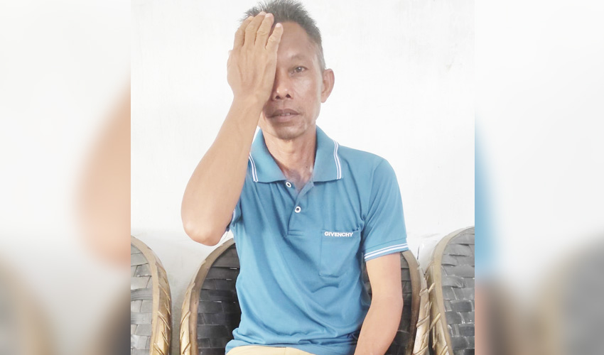 Suleman Samadi (48) warga Desa Karya Mukti Kecamatan Mootilango Kabupaten Gorontalo, yang saat ini mata kirinya telah menjadi buta permanen akibat penganiayaan sadis yang dilakukan HH menggunakan besi kunci ban mobil dum truk.