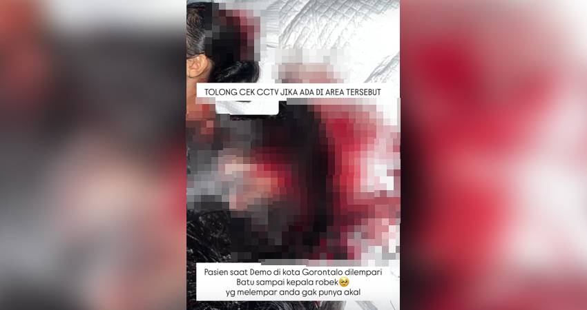 Foto luka yang dialami Ain menyebar cepat di media. (F.Istimewa)