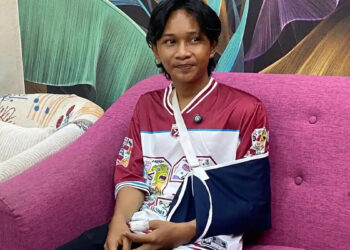 ‘Ti Fajar’ Ada Cilaka di Motor, Kuku Copot, Tangan Kiri Cidera